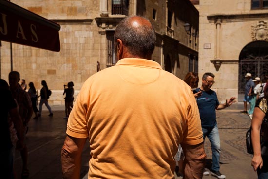 Le cuir chevelu dégarni / Espagne (2019)